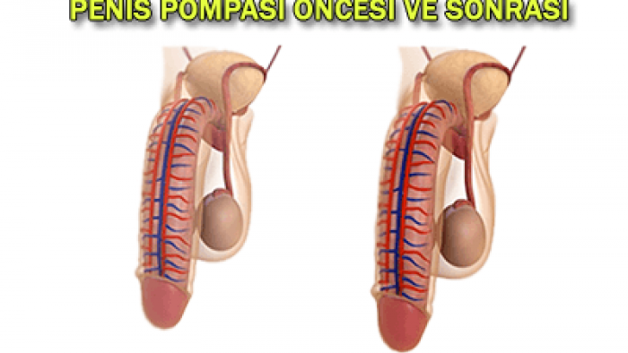 Doğal penis büyütme nasıl olur 