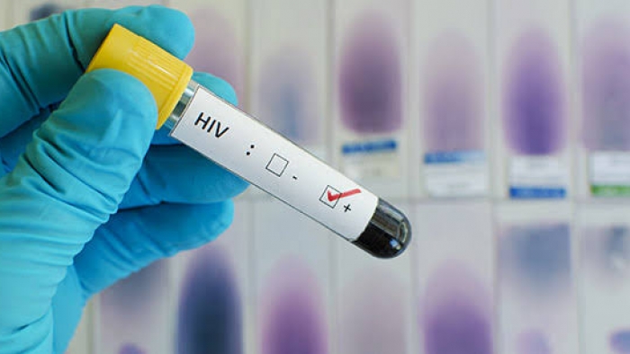 AIDS TESTİ NEREDE YAPILIR?