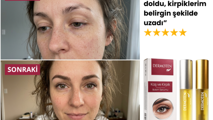 Kaş Kirpik Serumu Seçerken Nelere Dikkat Etmelisiniz?