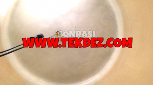 Suyla bulaşan hastalık; ishal